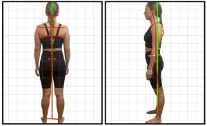 La valoración y el diagnóstico inicial es clave para los buenos resultados en las terapias de reeduación postural